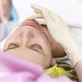 What’s the Deal with a Chemical Peel?