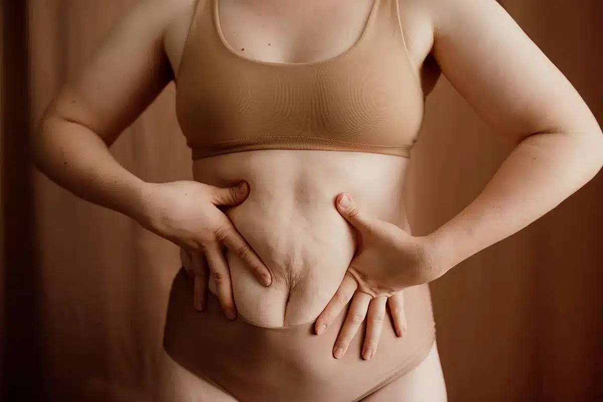 Woman showing her stomach skin.