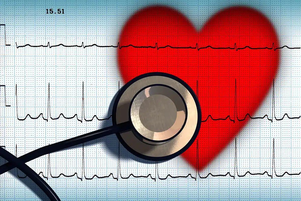 Stethoscope on EKG with heart graphic.