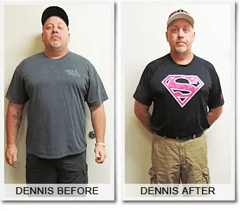 Dennis L: 65 lbs Weight Loss