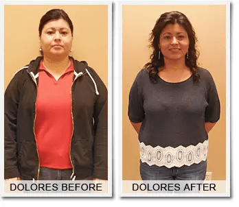 Dolores' 43.5 lbs Weight Loss Success Story
