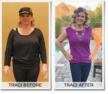 Traci's Weight Loss Success Story