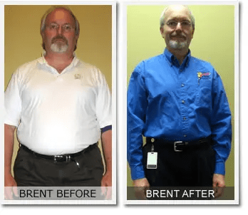 Brent’s 111 lb Weight Loss Success Story