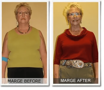 Marge's 53 lb Weight Loss