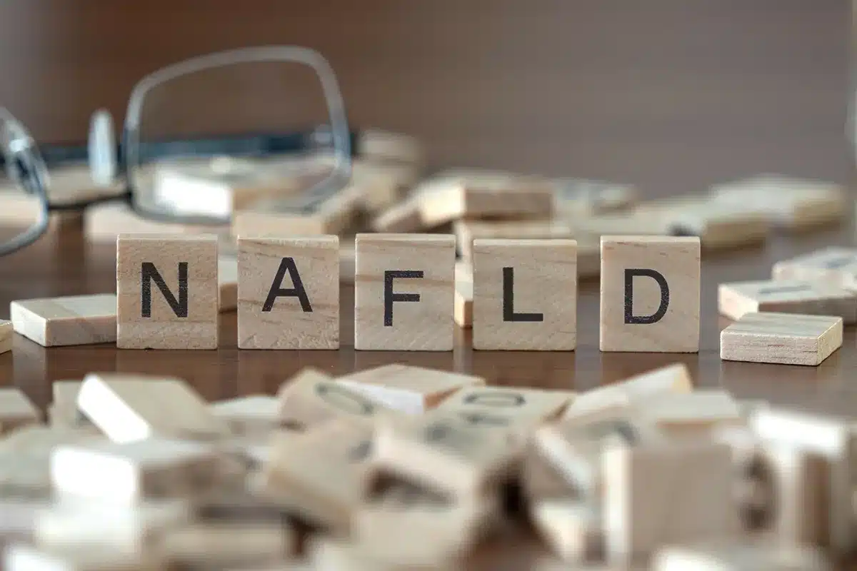 NAFLD spelled with letter tiles.