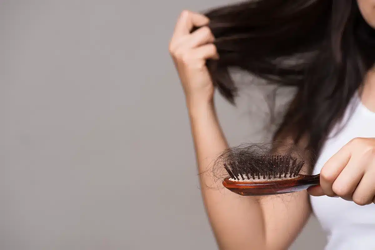 Woman holding hairbrush with excessive hair loss.