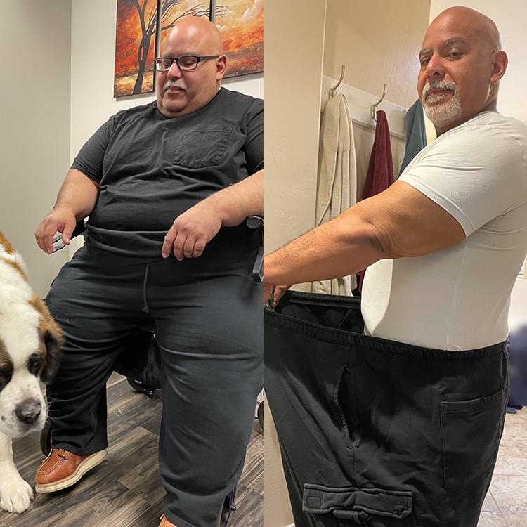 joshua weight loss before and after scottsdale weight loss center